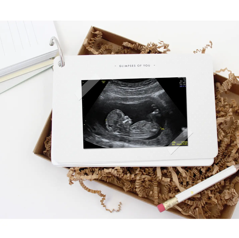 Baby Bump Journal